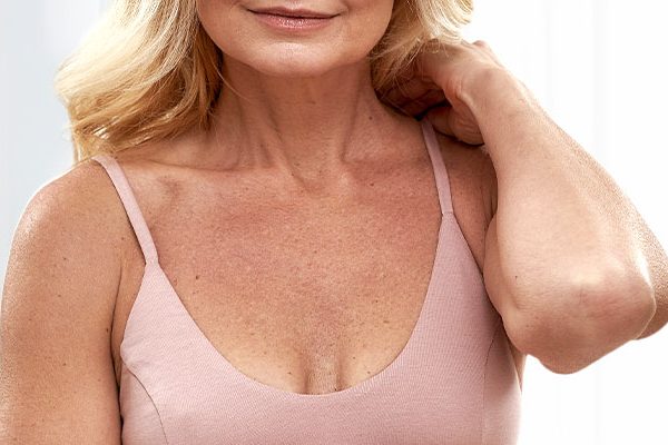 Brustverkleinerung mit 50 Jahren